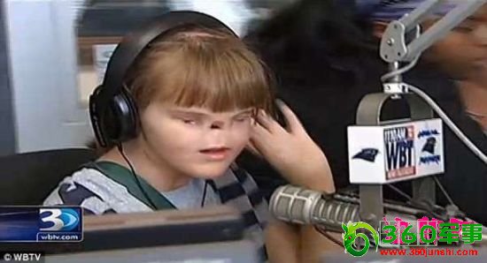 16岁女孩天生没有眼睛鼻子 16岁女孩天生没有眼睛鼻子